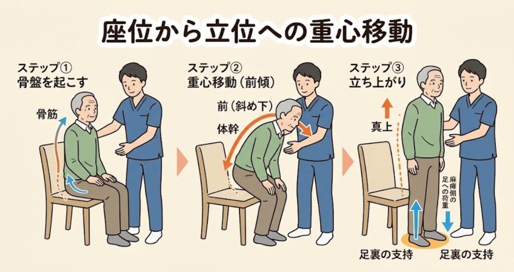 片麻痺患者さんの立ち上がり訓練